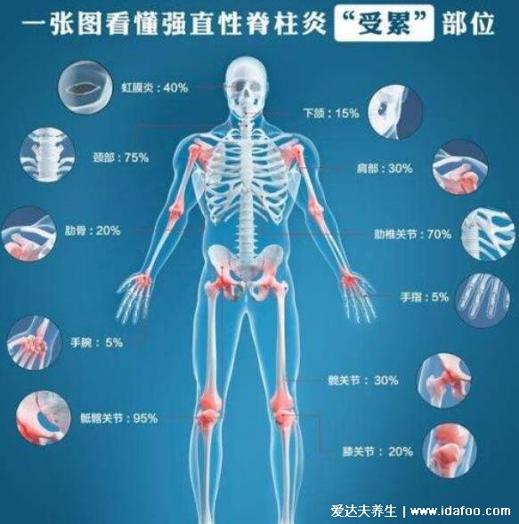 强直性脊柱炎的早期症状是什么，6大症状号称不死的癌症