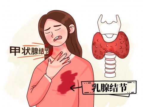 甲状腺和乳腺为什么经常一起长结节